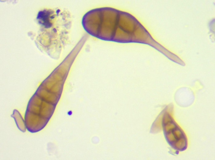 Otras partículas en suspensión de interés para la salud: polen, esporas, bacterias y virus.